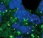 ATG12 Antibody in Immunocytochemistry (ICC/IF)