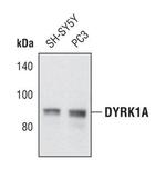 DYRK1A Antibody in Western Blot (WB)