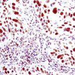 UBE1 Isoform A Antibody in Immunohistochemistry (Paraffin) (IHC (P))