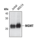 MGMT Antibody in Western Blot (WB)