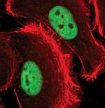 PRMT1 Antibody in Immunocytochemistry (ICC/IF)