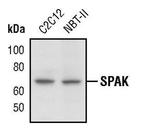 STK39 Antibody in Western Blot (WB)