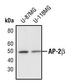 AP2 beta Antibody in Western Blot (WB)