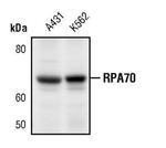 RPA70 Antibody in Western Blot (WB)