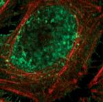 HSP40 Antibody in Immunocytochemistry (ICC/IF)