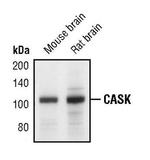 CASK Antibody in Western Blot (WB)