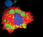 ATGL Antibody in Immunocytochemistry (ICC/IF)