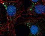 Profilin 1 Antibody in Immunocytochemistry (ICC/IF)