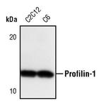 Profilin 1 Antibody in Western Blot (WB)