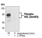 Phospho-HSL (Ser563) Antibody in Western Blot (WB)