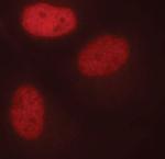 FosB Antibody in Immunocytochemistry (ICC/IF)