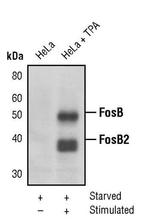 FosB Antibody in Western Blot (WB)