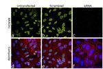 BRCA1 Antibody in Immunocytochemistry (ICC/IF)