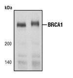 BRCA1 Antibody in Western Blot (WB)