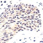 PPP2R2A Antibody in Immunohistochemistry (Paraffin) (IHC (P))