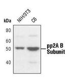 PPP2R2A Antibody in Western Blot (WB)