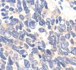 Ezrin Antibody in Immunohistochemistry (Paraffin) (IHC (P))