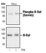 Phospho-B-Raf (Ser445) Antibody in Western Blot (WB)