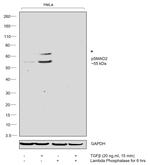 Phospho-SMAD2 (Ser245, Ser250, Ser255) Antibody