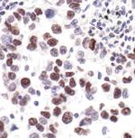 Phospho-RNA pol II CTD (Ser2, Ser5) Antibody in Immunohistochemistry (Paraffin) (IHC (P))