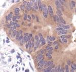 Acetyl-CoA Carboxylase Antibody in Immunohistochemistry (Paraffin) (IHC (P))