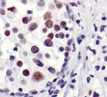 53BP1 Antibody in Immunohistochemistry (Paraffin) (IHC (P))