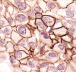 Phospho-EGFR (Tyr1148) Antibody in Immunohistochemistry (Paraffin) (IHC (P))