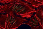 Phospho-Glucocorticoid Receptor (Ser211) Antibody in Immunocytochemistry (ICC/IF)