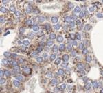 GNAQ Antibody in Immunohistochemistry (Paraffin) (IHC (P))