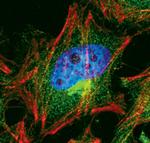 EEF2K Antibody in Immunocytochemistry (ICC/IF)