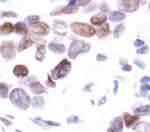 H2BK5ac Antibody in Immunohistochemistry (Paraffin) (IHC (P))