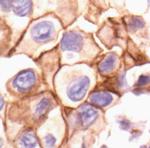 Phospho-SRC (Tyr527) Antibody in Immunohistochemistry (Paraffin) (IHC (P))