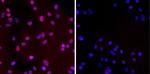 Phospho-CHK2 (Thr68) Antibody