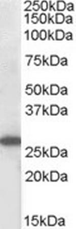 SOCS3 Antibody in Western Blot (WB)