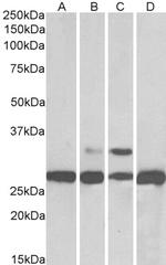 PGAM1/PGAM2/PGAM4 Antibody in Western Blot (WB)