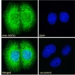 SOCS1 Antibody in Immunocytochemistry (ICC/IF)