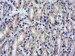 SOCS1 Antibody in Immunohistochemistry (Paraffin) (IHC (P))