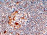 ZCCHC11 Antibody in Immunohistochemistry (Paraffin) (IHC (P))