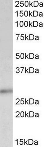 p27 Kip1 Antibody in Western Blot (WB)