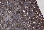 SET Antibody in Immunohistochemistry (Paraffin) (IHC (P))