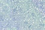 SET Antibody in Immunohistochemistry (Paraffin) (IHC (P))