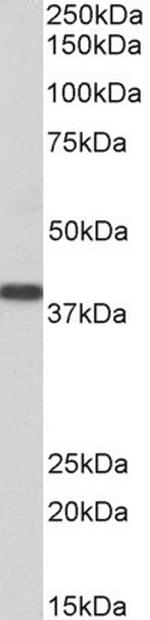 SET Antibody in Western Blot (WB)