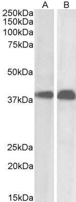 SET Antibody in Western Blot (WB)