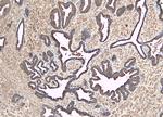 MKP-1 Antibody in Immunohistochemistry (Paraffin) (IHC (P))