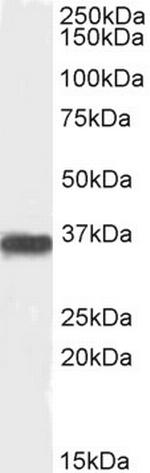 PP2A alpha/beta Antibody in Western Blot (WB)