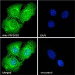 PPP2R5D Antibody in Immunocytochemistry (ICC/IF)