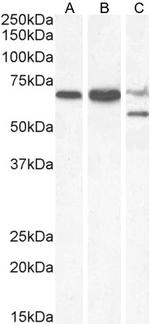 PPP2R5D Antibody in Western Blot (WB)