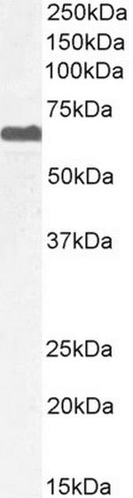 PPP2R5D Antibody in Western Blot (WB)