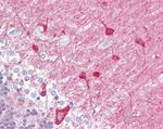 PACSIN1 Antibody in Immunohistochemistry (Paraffin) (IHC (P))