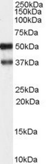 PACSIN1 Antibody in Western Blot (WB)